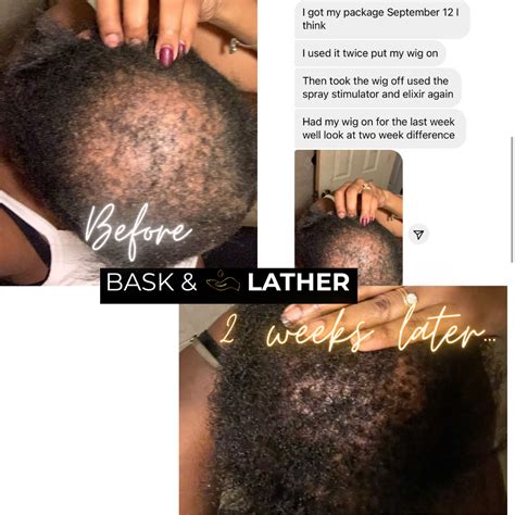 Rosemary Oil For Hair Growth Before And After Bask And Lather Co