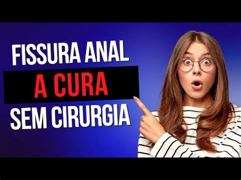 Encontrei A Cura Da Fissura Anal Cr Nica Tratamento Sem Cirurgia Youtube