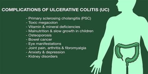 Ulcerative Colitis Causes Risk Factors And Complications