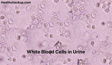 What Does White Blood Cells In Urine Mean Health Checkup