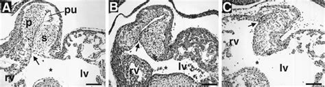 Lack Of Conotruncal Rotation In E Perlecan Deficient Embryos