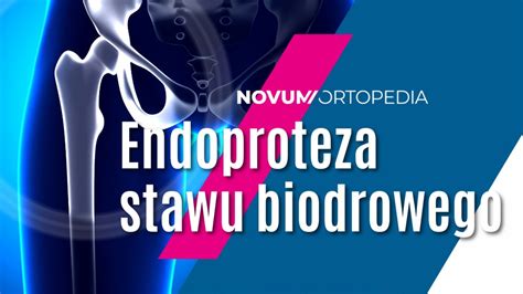 Budowa i funkcjonalność endoprotezy stawu biodrowego Novum Ortopedia