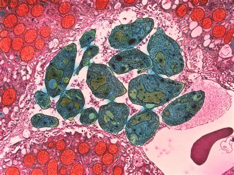 Tem Of Toxoplasma Gondii Parasites Photograph By Moredun Scientific Ltd