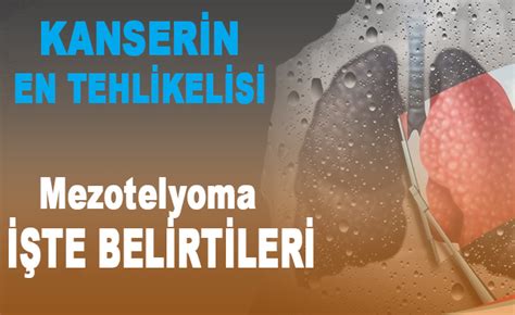 Mezotelyoma nedir Akciğer zarı kanseri Bafra Haber Bafra Haberleri