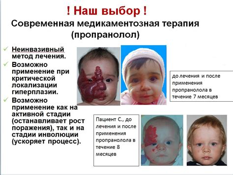 Пропранолол: инструкция по применению, цена, отзывы, аналоги и механизм ...
