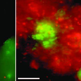 Fluorescent Micrographs Of Live Green Dead Red Stained Biofilm From