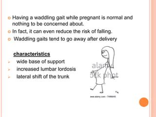 Waddling gait- definition|role of muscle|gait analysis|kinematic and spatiotemporal deviations ...