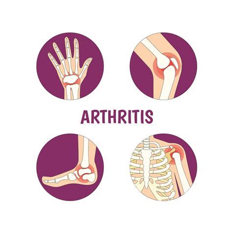 My ankle tells me it will be cold and rainy today | Brucato Foot and