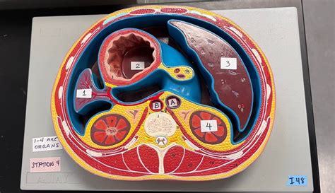 Transverse Abdominal Section Diagram Quizlet