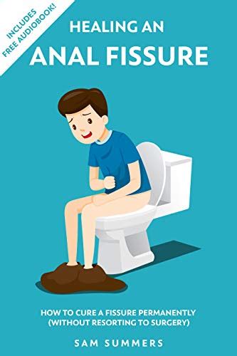 Healing An Anal Fissure How To Cure A Fissure Permanently By Sam Summers Goodreads