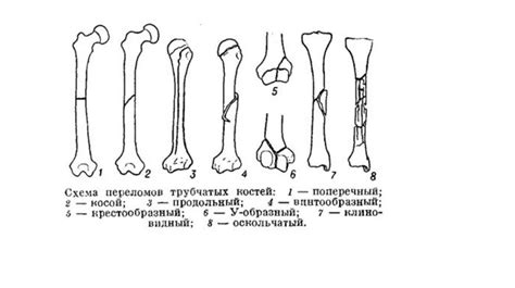 Повреждения и травмы - online presentation