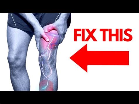 How to Fix Thigh and Leg (Femoral Nerve) Pain Fast | Meralgia ...