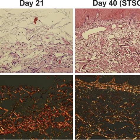 Histological Samples Stained With Haematoxylin Eosin H E And Sirius