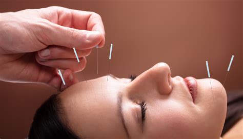 Can Acupuncture Relieve Hot Flashes Symptoms MeNovating