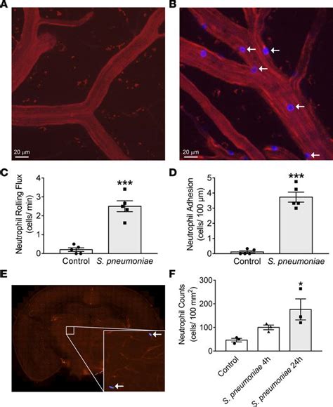 JCI Insight Targeting Inflammatory Monocytes In Sepsis Associated