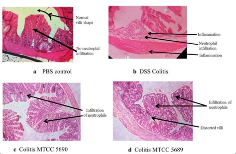 Histology of colonic tissues of different groups of colitis mice ...