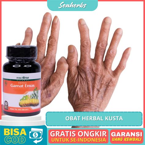 Jual Obat Untuk Penyakit Kusta Alami Kusta Kering Basah Lepra Infeksi