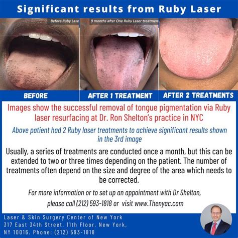 Lab Black Spot On Tongue At Michael Brehm Blog