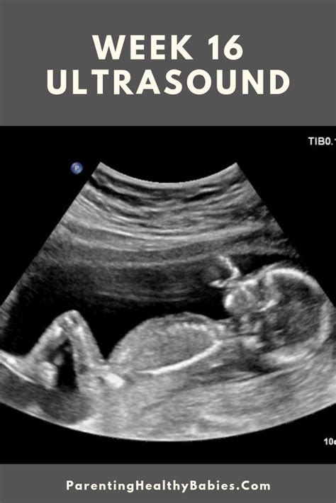 Ultrasound Clinic Artofit