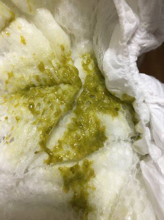 Baby Poop Bright Green