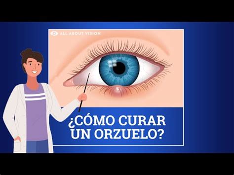 Que Es Bueno Para Una Bolita En El Ojo Consejos Ojos