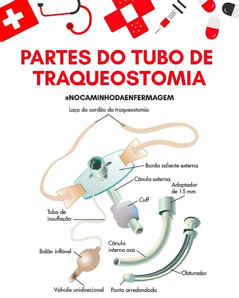 Como É Feita A Traqueostomia - Etapas Do Procedimento De Traqueostomia