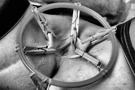 Opened Pussy By Hard Stretching Scrolller