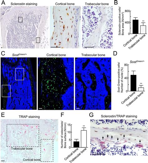 Localization Of Sclerostin Positive Osteocytes And Osteoclasts In