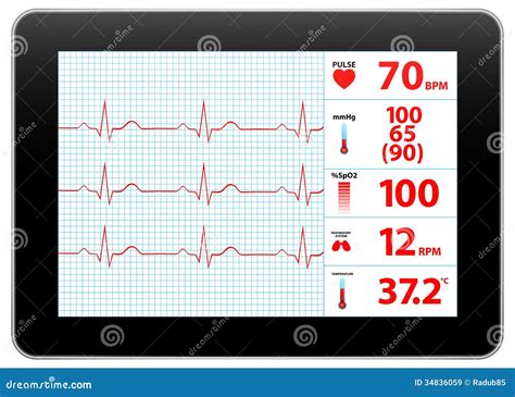 Modern Electrocardiogram Monitor Device Display Royalty Free Stock