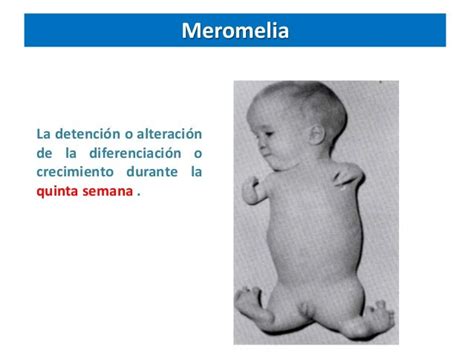 Enfermedades Ii