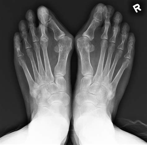 History | HK Foot and Ankle