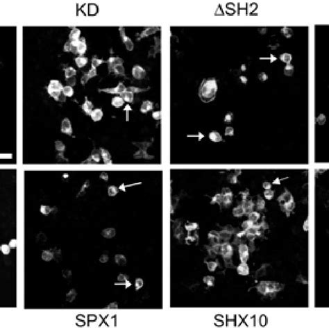reverse transfection cell array   transfection  gfp  lacz