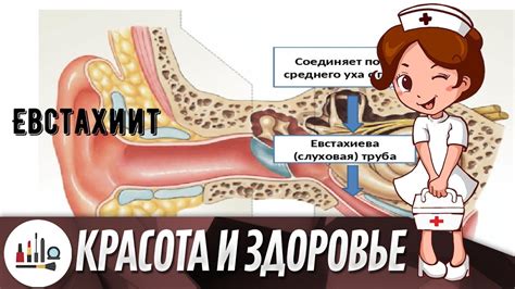 Евстахиит — симптомы и лечение