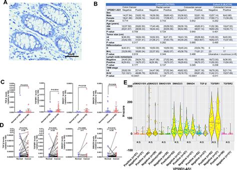 Figures And Data In Vps D As Overexpression Amplifies Intratumoral