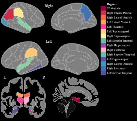 Illustration Of The Cortical And Subcortical Brain Regions With The