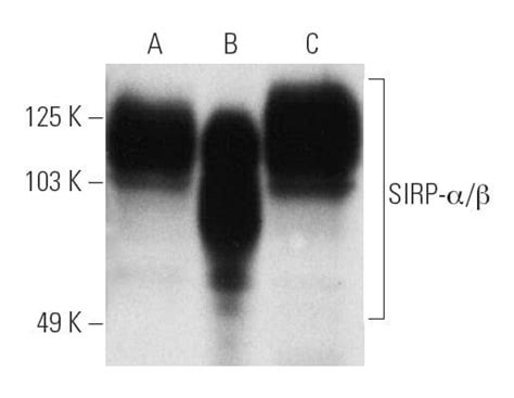 Sirp A Scbt Santa Cruz Biotechnology