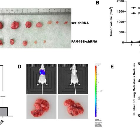 Effects Of FAM49B On Proliferation And Migration In Vivo AC