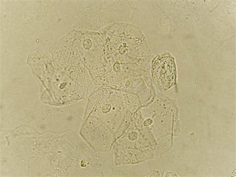 Raras Celulas Epiteliais Na Urina - Células Epiteliais Na Urina Raras - RETOEDU