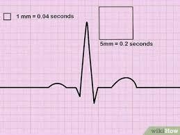 Cardio Intro To Ekg Flashcards Quizlet