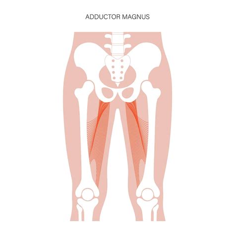 Right Adductor Strain