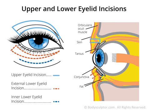 upper lid anatomy