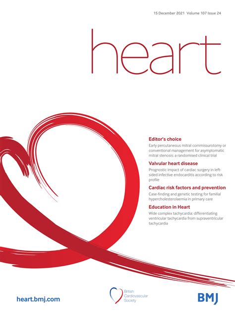 Wide Complex Tachycardia Differentiating Ventricular Tachycardia From