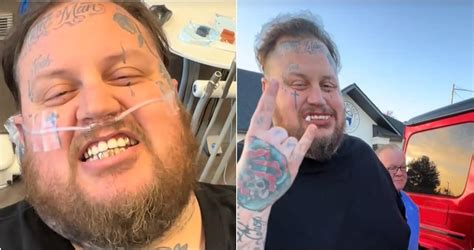 See Inside The Journey Of Jelly Roll's Mouth Transformation - Country Now