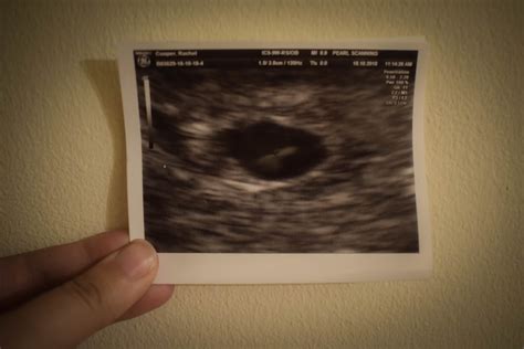 Three Weeks On From My Miscarriage