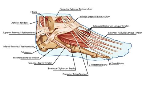 Extensor Tendonitis Of The Foot Explained By A Foot Specialist