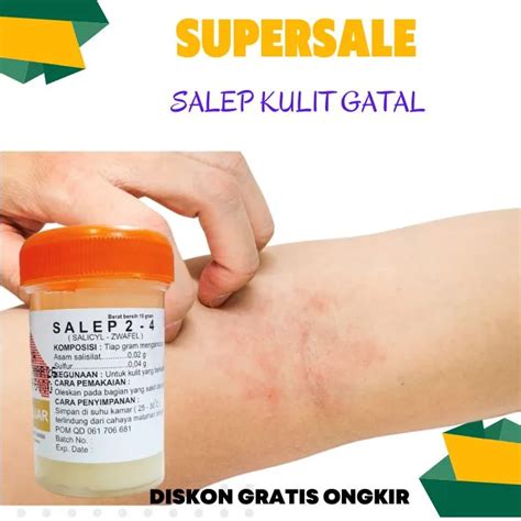 Itchy Skin Ointment Obat Eksim Basah Salep Buat Untuk Kulit Kering