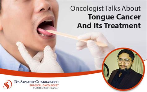 Oncologist Talks About Tongue Cancer And Its Treatment