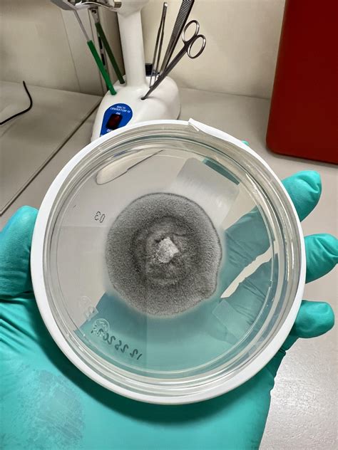 Handsome molds for your viewing pleasure! : r/microbiology