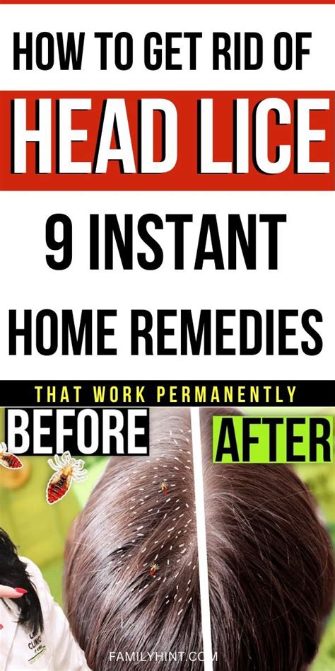 how to treat lice at home