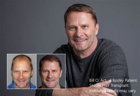 Bosley – Hair Restoration & Transplant – Seattle | Hair Transplant Location
